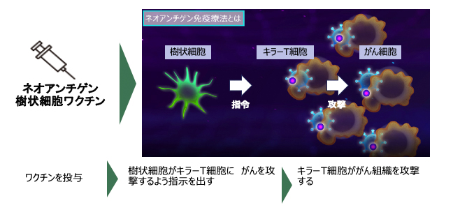 ネオアンチゲン＋樹状細胞ワクチン治療